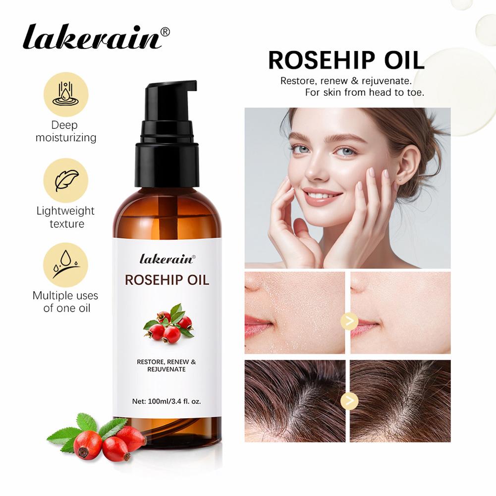Cold Pressed Rose Hip - Yüz ve Cilt İçin Kuşburnu Yağı