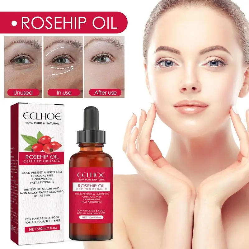 Cold Pressed Rose Hip - 30 ml Organik Kuşburnu Tohumu Yağı